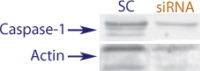 Western blot data demonstrating successful knockdown of UVB irradiation induced Caspase-1 in human cells 72 hours after treatment with QX38 siRNA (SC = Scrambled Control (Product Number QC1), siRNA = QX38 treatment)