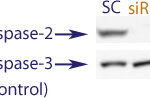 Western blot data demonstrating successful knockdown of Caspase-2 in doxorubicin treated human cells 48 hours after treatment with QX39 siRNA (SC = Scrambled Control (Product Number QC1), siRNA = QX39 treatment)