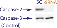 Western blot data demonstrating successful knockdown of Caspase-2 in doxorubicin treated human cells 48 hours after treatment with QX39 siRNA (SC = Scrambled Control (Product Number QC1), siRNA = QX39 treatment)