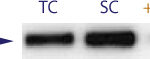 Western blot data demonstrating successful knockdown of Androgen Receptor Protein by QX4 (TC = Transfection Control, SC = Scrambled Control (Product Number QC1), siRNA = QX4 treatment)