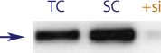 Western blot data demonstrating successful knockdown of Androgen Receptor Protein by QX4 (TC = Transfection Control, SC = Scrambled Control (Product Number QC1), siRNA = QX4 treatment)