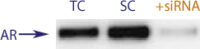 Western blot data demonstrating successful knockdown of Androgen Receptor Protein by QX4 (TC = Transfection Control, SC = Scrambled Control (Product Number QC1), siRNA = QX4 treatment)