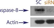 Western blot data demonstrating successful knockdown of Caspase-9 in treated human cells approximately 60 hours after treatment with QX43 siRNA (SC = Scrambled Control (Product Number QC1), siRNA = QX43 treatment)