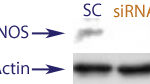 Western blot data demonstrating successful knockdown of iNOS in treated human cells approximately 8 days after treatment with QX45 siRNA.  QX45 transfection was performed again at Day 4 to ensure lasting iNOS knockdown (SC = Scrambled Control (Product Number QC1), siRNA = QX45 treatment)