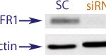 Western blot data demonstrating successful knockdown of IGF1R in human cells approximately 48 hours after treatment with QX46 siRNA (SC = Scrambled Control (Product Number QC1), siRNA = QX46 treatment)