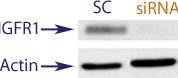 Western blot data demonstrating successful knockdown of IGF1R in human cells approximately 48 hours after treatment with QX46 siRNA (SC = Scrambled Control (Product Number QC1), siRNA = QX46 treatment)