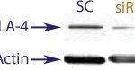 Western blot data demonstrating successful knockdown of CTLA4 in human cells approximately72 hours after treatment with QX47 siRNA (SC = Scrambled Control (Product Number QC1), siRNA = QX47 treatment)