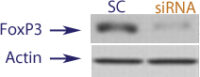 Western blot data demonstrating successful knockdown of Foxp3 in human cells approximately 24 hours after treatment with QX48 siRNA (SC = Scrambled Control (Product Number QC1), siRNA = QX48 treatment)