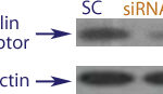 Western blot data demonstrating successful knockdown of Insulin Receptor in human cells approximately 72 hours after treatment with QX51 siRNA (SC = Scrambled Control (Product Number QC1), siRNA = QX51 treatment)