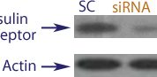 Western blot data demonstrating successful knockdown of Insulin Receptor in human cells approximately 72 hours after treatment with QX51 siRNA (SC = Scrambled Control (Product Number QC1), siRNA = QX51 treatment)