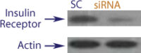 Western blot data demonstrating successful knockdown of Insulin Receptor in human cells approximately 72 hours after treatment with QX51 siRNA (SC = Scrambled Control (Product Number QC1), siRNA = QX51 treatment)