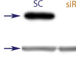 Western blot data demonstrating successful knockdown of BAX by QX6 at 48 hrs post transfection (SC = Scrambled Control (Product Number QC1), siRNA = QX6 treatment)