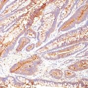 Western Blot of human Stomach Lysate using CEA Monoclonal Antibody (COL-1).