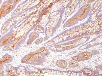 Western Blot of human Stomach Lysate using CEA Monoclonal Antibody (COL-1).