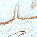 Formalin-fixed, paraffin-embedded human Cervix stained with Podoplanin Monoclonal Antibody (PDPN/1433). Dilution: 1:250