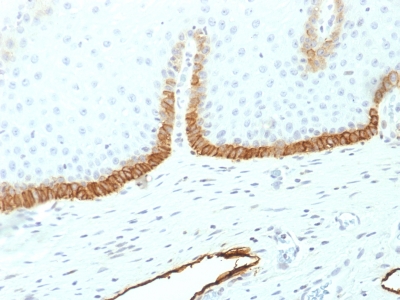 Formalin-fixed, paraffin-embedded human Cervix stained with Podoplanin Monoclonal Antibody (PDPN/1433). Dilution: 1:250