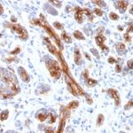 Formalin-fixed, paraffin-embedded human Pancreas stained with CFTR Monoclonal Antibody (CFTR/1341).