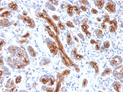 Formalin-fixed, paraffin-embedded human Pancreas stained with CFTR Monoclonal Antibody (CFTR/1341).