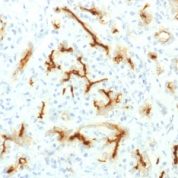 Formalin-fixed, paraffin-embedded Human Pancreas stained with CFTR Recombinant Rabbit Monoclonal Antibody (CFTR/1775R).