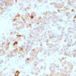 Formalin-fixed, paraffin-embedded human Pituitary stained with LH alpha Monoclonal Antibody (LHa/756).