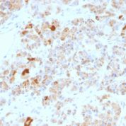 Formalin-fixed, paraffin-embedded human Pituitary stained with LH alpha Monoclonal Antibody (LHa/756).