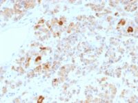 Formalin-fixed, paraffin-embedded human Pituitary stained with LH alpha Monoclonal Antibody (LHa/756).