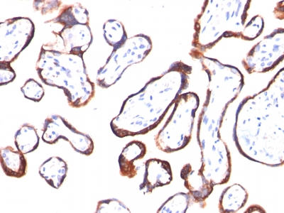 Formalin-fixed, paraffin-embedded human Placenta stained with hCG beta Monoclonal Antibody (HCGb/54).