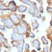 Formalin-fixed, paraffin-embedded human Placenta stained with hCG beta Monoclonal Antibody (SPM15).