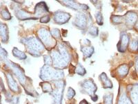 Formalin-fixed, paraffin-embedded human Placenta stained with hCG beta Monoclonal Antibody (SPM15).