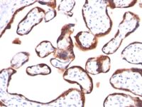 Formalin-fixed, paraffin-embedded human Placenta stained with hCG beta Monoclonal Antibody (HCGb/459).