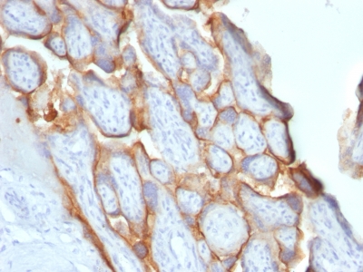 Formalin-fixed, paraffin-embedded human Placenta stained with hCG beta Monoclonal Antibody (SPM529).