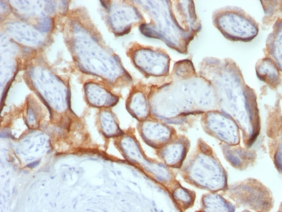 Formalin-fixed, paraffin-embedded human Placenta stained with hCG beta Ab (HCGb/54 + HCGb/459).