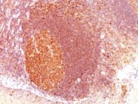 Formalin-fixed, paraffin-embedded human Tonsil stained with MALT1 Monoclonal Antibody (SPM578)