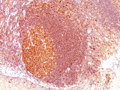 Formalin-fixed, paraffin-embedded human Tonsil stained with MALT1 Monoclonal Antibody (SPM578)