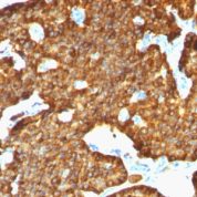 Formalin-fixed, paraffin-embedded human Pancreas stained with Chromogranin A Monoclonal Antibody (SPM553).