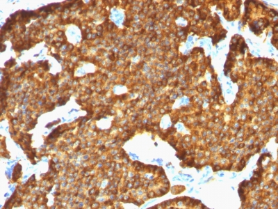 Formalin-fixed, paraffin-embedded human Pancreas stained with Chromogranin A Monoclonal Antibody (SPM553).