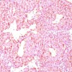 Formalin-fixed, paraffin-embedded human Adrenal Gland stained with Chromogranin A Monoclonal Antibody (PHE5)