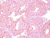 Formalin-fixed, paraffin-embedded human Adrenal Gland stained with Chromogranin A Monoclonal Antibody (PHE5)