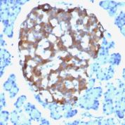 Formalin-fixed, paraffin-embedded human Parathyroid stained with Chromogranin A Monoclonal Antibody (CHGA/765)