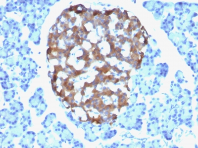 Formalin-fixed, paraffin-embedded human Parathyroid stained with Chromogranin A Monoclonal Antibody (CHGA/765)