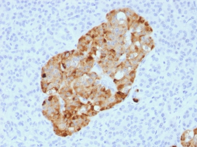 Formalin-fixed, paraffin-embedded human Parathyroid stained with Chromogranin A Recombinant Rabbit Monoclonal Antibody (CHGA/1731R)