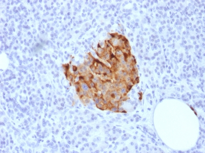 Formalin-fixed, paraffin-embedded human Parathyroid stained with Chromogranin A Recombinant Rabbit Monoclonal Antibody (CHGA/1773R)