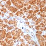 Formalin-fixed, paraffin-embedded Human Pancreas stained with Clathrin, LC Monoclonal Antibody (SPM174).