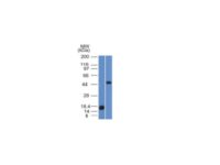 Flow Cytometry of human Adipophilin on PBMC. Green: Isotype Control; Red: Adipophilin Monoclonal Antibody (ADFP/1365).