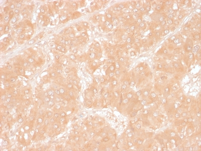 Formalin-fixed, paraffin-embedded human Adrenal stained with Adipophilin Monoclonal Antibody (ADFP/1366).
