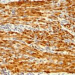 Formalin-fixed, paraffin-embedded human Uterus stained with Calponin-1 Monoclonal Antibody (SPM169).