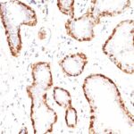 Formalin-fixed, paraffin-embedded human Uterus stained with Calponin-1 Monoclonal Antibody (CNN1/832).