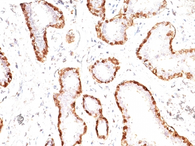 Formalin-fixed, paraffin-embedded human Uterus stained with Calponin-1 Monoclonal Antibody (CNN1/832).