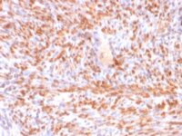 Formalin-fixed, paraffin-embedded human Uterus stained with Calponin-1 Recombinant Mouse Monoclonal Antibody (rCNN1/832).