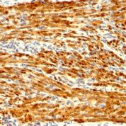 Formalin-fixed, paraffin-embedded Rat Uterus stained with Calponin Recombinant Rabbit Monoclonal Antibody (CNN1/148R).
